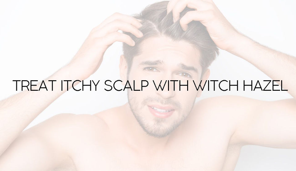 Treat itchy scalp with Witch Hazel